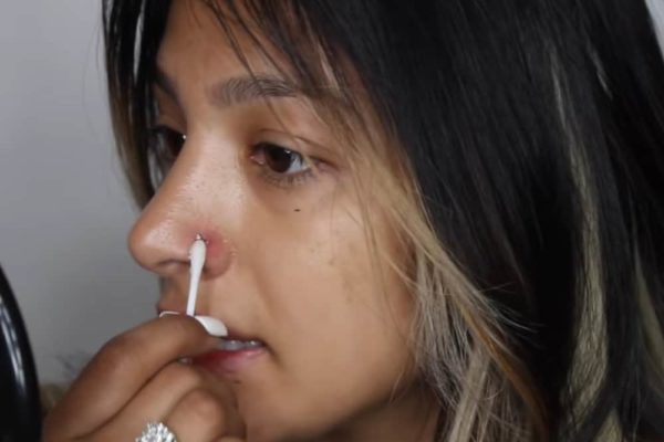 10 Tips to Treat an Infected Nose Piercing
