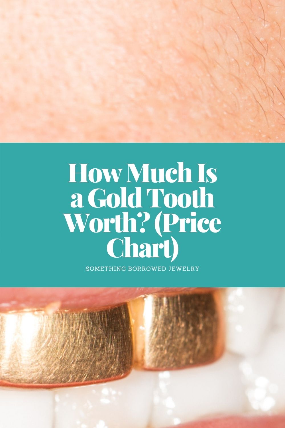 How Much Is a Gold Tooth Worth (Price Chart) pin 2