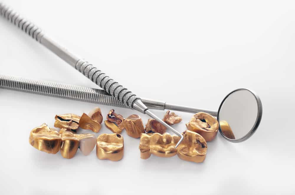 proč je zlato dobré pro stomatologii