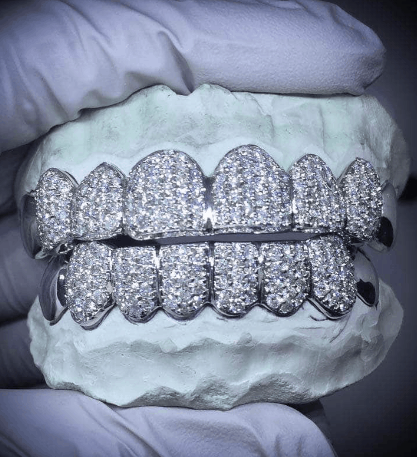 How Much Is Diamond Grillz